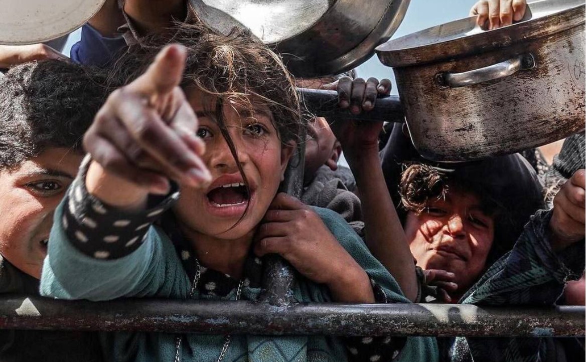 العدوان الصهيوني على غزة:كولومبيا تستقبل أطفال غزة المصابين لتلقي العلاج في مستشفياتها العسكرية